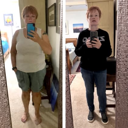 Mary Lynn, 66 - before and after