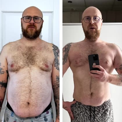 Tomek, 39 - before and after